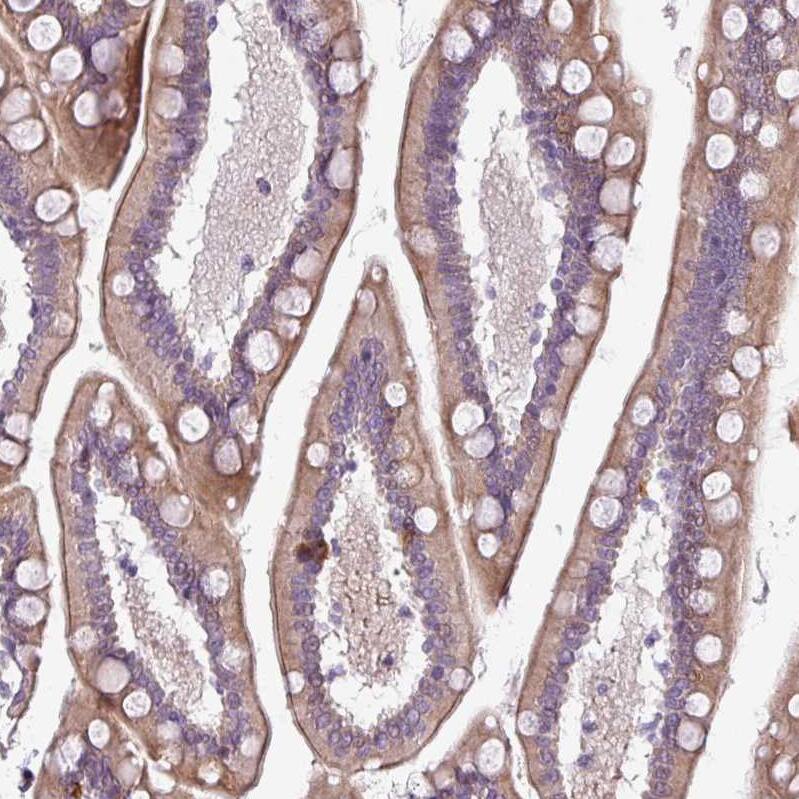 Chordin-like 1/CHRDL1 Antibody - BSA Free Immunohistochemistry-Paraffin: Chordin-like 1/CHRDL1 Antibody - BSA Free [NBP1-84485]