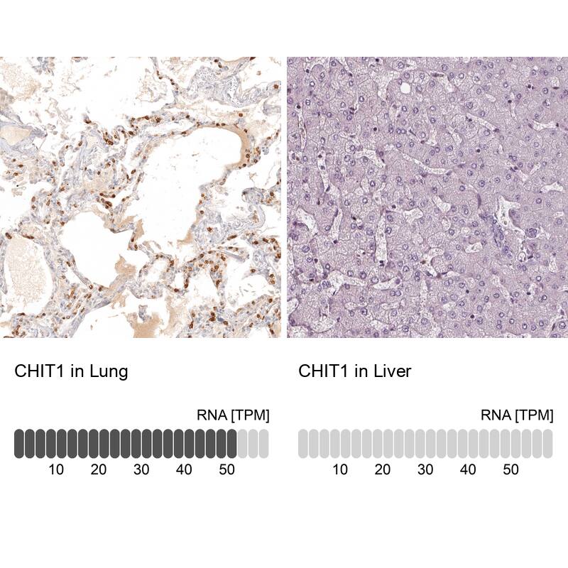 Chitotriosidase/CHIT1 Antibody - BSA Free Immunohistochemistry-Paraffin: Chitotriosidase/CHIT1 Antibody - BSA Free [NBP1-84490]