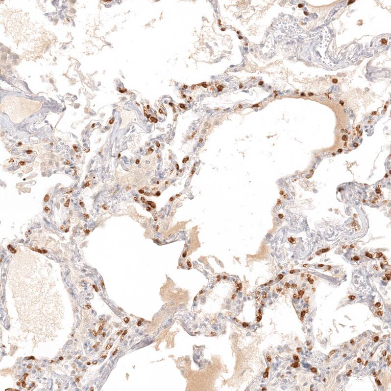 Chitotriosidase/CHIT1 Antibody - BSA Free Immunohistochemistry-Paraffin: Chitotriosidase/CHIT1 Antibody - BSA Free [NBP1-84490]