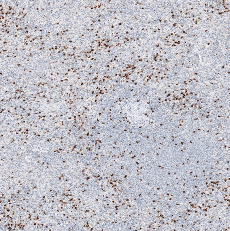 Chitotriosidase/CHIT1 Antibody - BSA Free Immunohistochemistry-Paraffin: Chitotriosidase/CHIT1 Antibody - BSA Free [NBP1-84490]