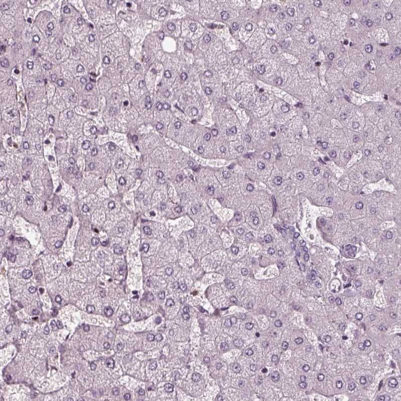 Chitotriosidase/CHIT1 Antibody - BSA Free Immunohistochemistry-Paraffin: Chitotriosidase/CHIT1 Antibody - BSA Free [NBP1-84490]