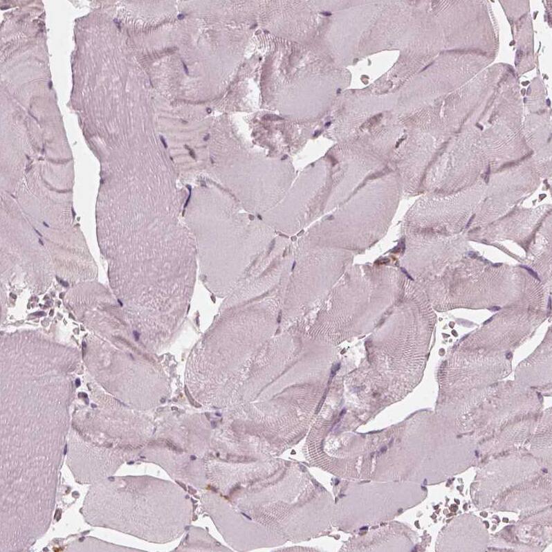 Chitotriosidase/CHIT1 Antibody - BSA Free Immunohistochemistry-Paraffin: Chitotriosidase/CHIT1 Antibody - BSA Free [NBP1-84490]