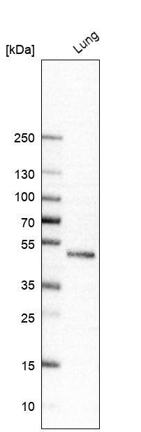 Chitotriosidase/CHIT1 Antibody - BSA Free Western Blot: Chitotriosidase/CHIT1 Antibody - BSA Free [NBP1-84490]