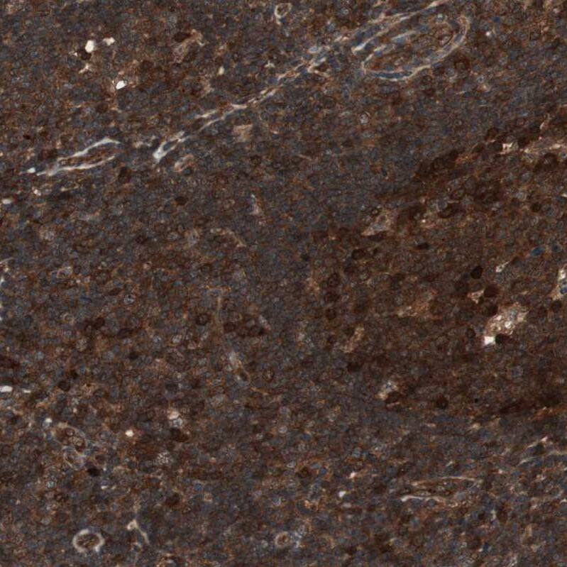 cGK2/PRKG2 Antibody - BSA Free Immunohistochemistry-Paraffin: cGK2/PRKG2 Antibody - BSA Free [NBP1-84497]