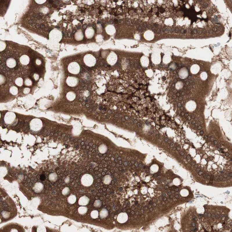 cGK2/PRKG2 Antibody - BSA Free Immunohistochemistry-Paraffin: cGK2/PRKG2 Antibody - BSA Free [NBP1-84497]