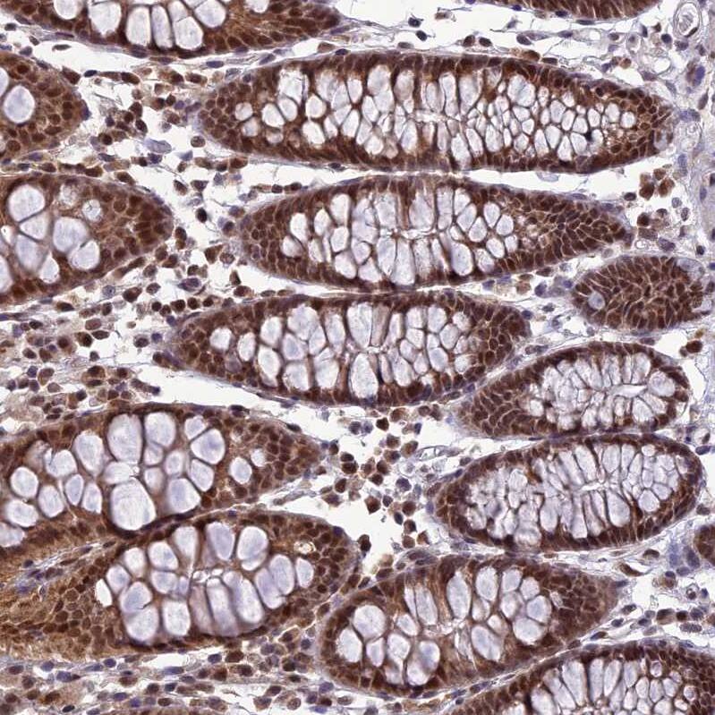 CLE7 homolog Antibody - BSA Free Immunohistochemistry-Paraffin: CLE7 homolog Antibody - BSA Free [NBP1-84498]