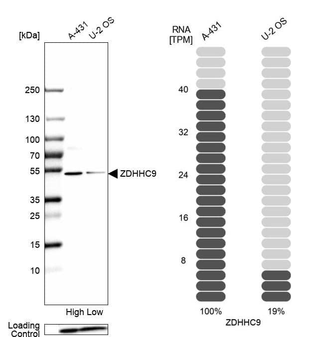 ZDHHC9 Antibody - BSA Free Western Blot: ZDHHC9 Antibody - BSA Free [NBP1-84499]