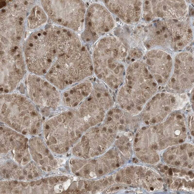 TTC15 Antibody - BSA Free Immunohistochemistry-Paraffin: TTC15 Antibody - BSA Free [NBP1-84500]