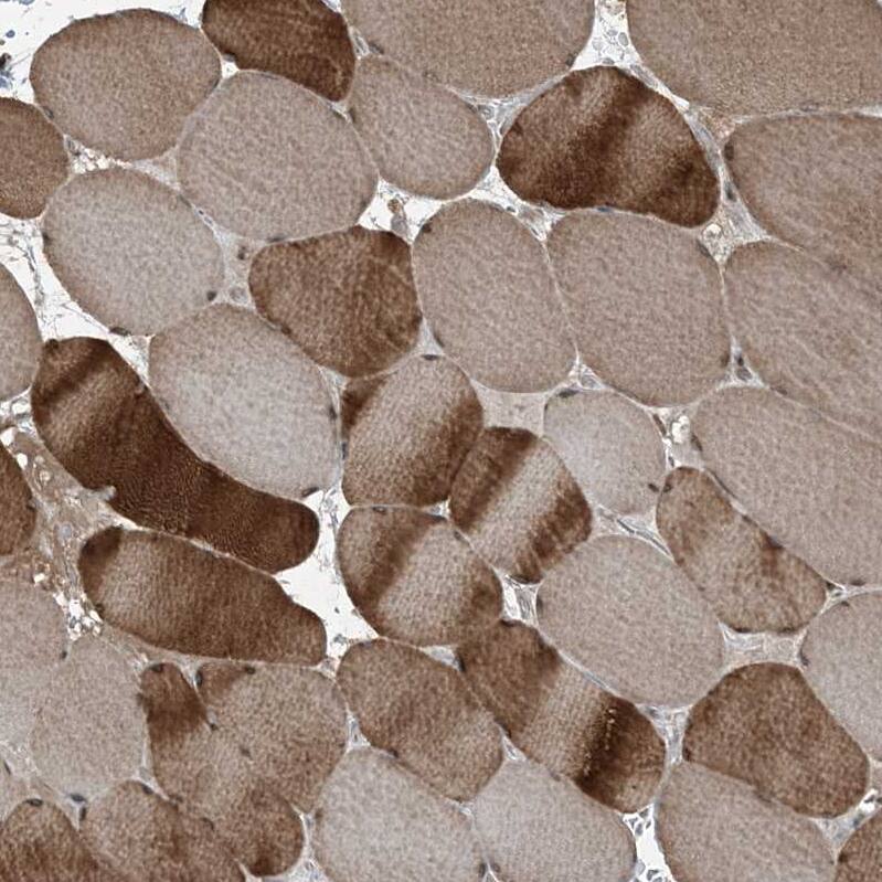 TTC15 Antibody - BSA Free Immunohistochemistry-Paraffin: TTC15 Antibody - BSA Free [NBP1-84500]