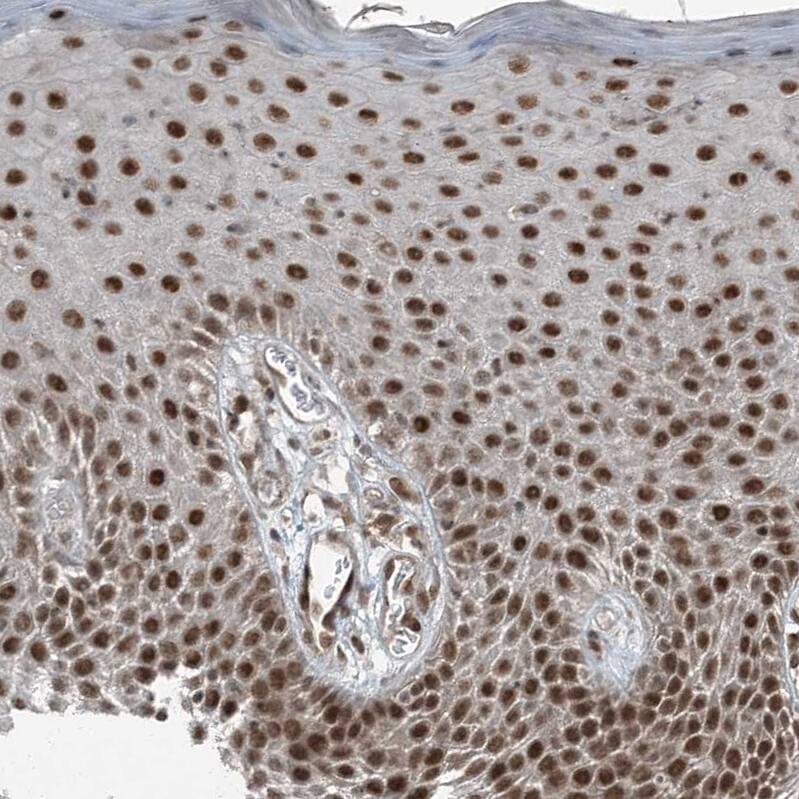 TTC15 Antibody - BSA Free Immunohistochemistry-Paraffin: TTC15 Antibody - BSA Free [NBP1-84500]