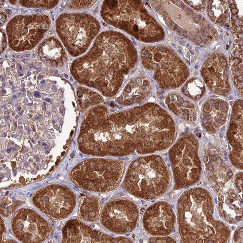 NDUFAF1 Antibody - BSA Free Immunohistochemistry-Paraffin: NDUFAF1 Antibody [NBP1-84503]