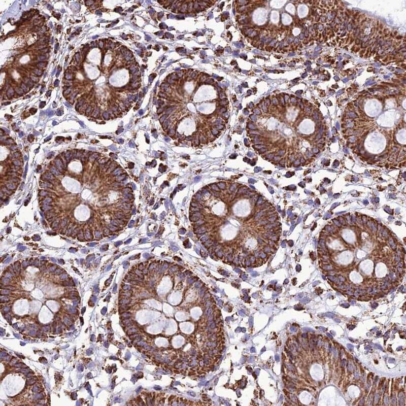 NDUFAF1 Antibody - BSA Free Immunohistochemistry-Paraffin: NDUFAF1 Antibody [NBP1-84504]