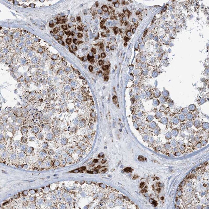 SAMM50 Antibody - BSA Free Immunohistochemistry-Paraffin: SAMM50 Antibody - BSA Free [NBP1-84509]