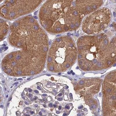 AMDHD2 Antibody - BSA Free Immunohistochemistry-Paraffin: AMDHD2 Antibody [NBP1-84515]