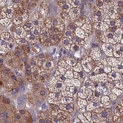 AMDHD2 Antibody - BSA Free Immunohistochemistry-Paraffin: AMDHD2 Antibody [NBP1-84515]