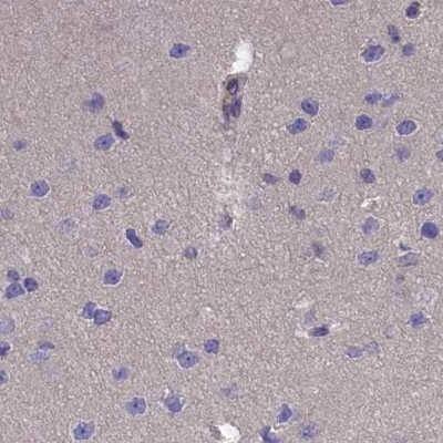 AMDHD2 Antibody - BSA Free Immunohistochemistry-Paraffin: AMDHD2 Antibody [NBP1-84515]