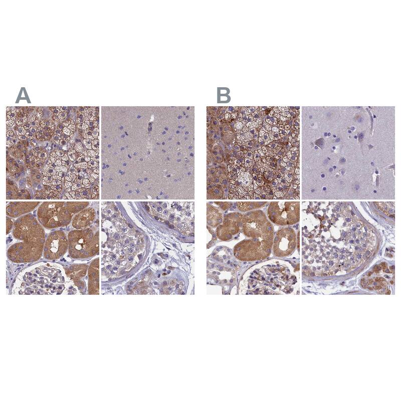 AMDHD2 Antibody - BSA Free Immunohistochemistry-Paraffin: AMDHD2 Antibody [NBP1-84515]