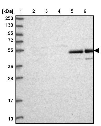 AMDHD2 Antibody - BSA Free Western Blot: AMDHD2 Antibody - BSA Free [NBP1-84515]