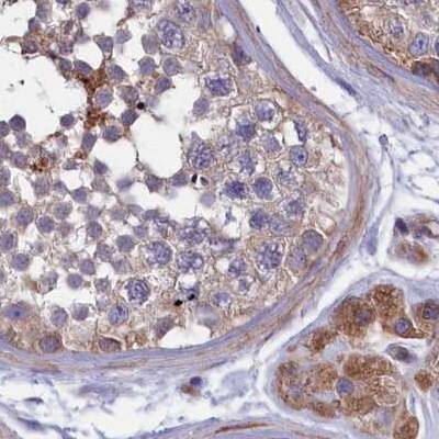 AMDHD2 Antibody - BSA Free Immunohistochemistry-Paraffin: AMDHD2 Antibody [NBP1-84516]