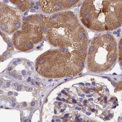 AMDHD2 Antibody - BSA Free Immunohistochemistry-Paraffin: AMDHD2 Antibody [NBP1-84516]