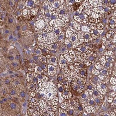 AMDHD2 Antibody - BSA Free Immunohistochemistry-Paraffin: AMDHD2 Antibody [NBP1-84516]