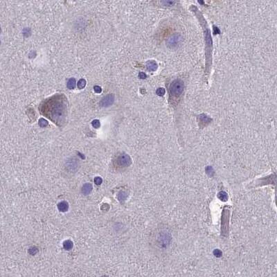 AMDHD2 Antibody - BSA Free Immunohistochemistry-Paraffin: AMDHD2 Antibody [NBP1-84516]