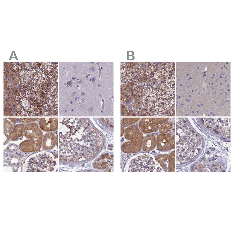 AMDHD2 Antibody - BSA Free Immunohistochemistry-Paraffin: AMDHD2 Antibody [NBP1-84516]