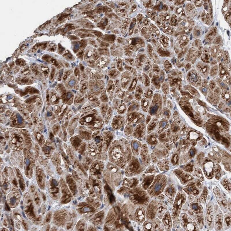 MRPS23 Antibody - BSA Free Immunohistochemistry-Paraffin: MRPS23 Antibody [NBP1-84518]