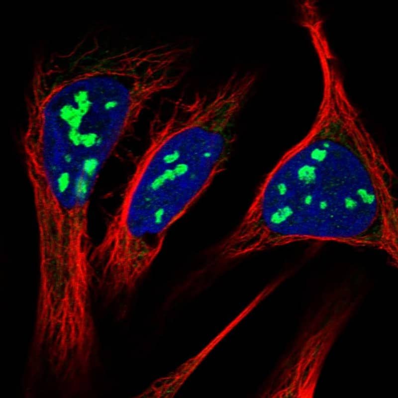 RRP15 Antibody - BSA Free Immunocytochemistry/ Immunofluorescence: RRP15 Antibody [NBP1-84522]