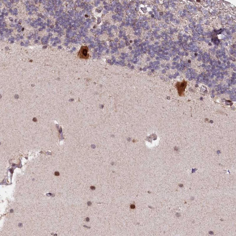 N4BP2L1 Antibody - BSA Free Immunohistochemistry-Paraffin: N4BP2L1 Antibody [NBP1-84531]