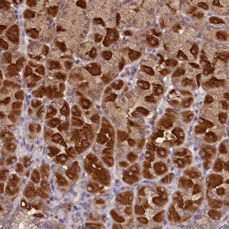 NUBP2 Antibody - BSA Free Immunohistochemistry-Paraffin: NUBP2 Antibody - BSA Free [NBP1-84533]