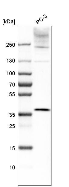 LASS2 Antibody - BSA Free Western Blot: LASS2 Antibody - BSA Free [NBP1-84537]