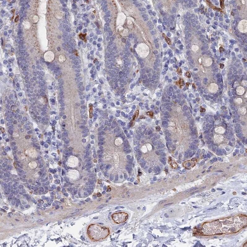 ARAP3 Antibody - BSA Free Immunohistochemistry-Paraffin: ARAP3 Antibody - BSA Free [NBP1-84541]