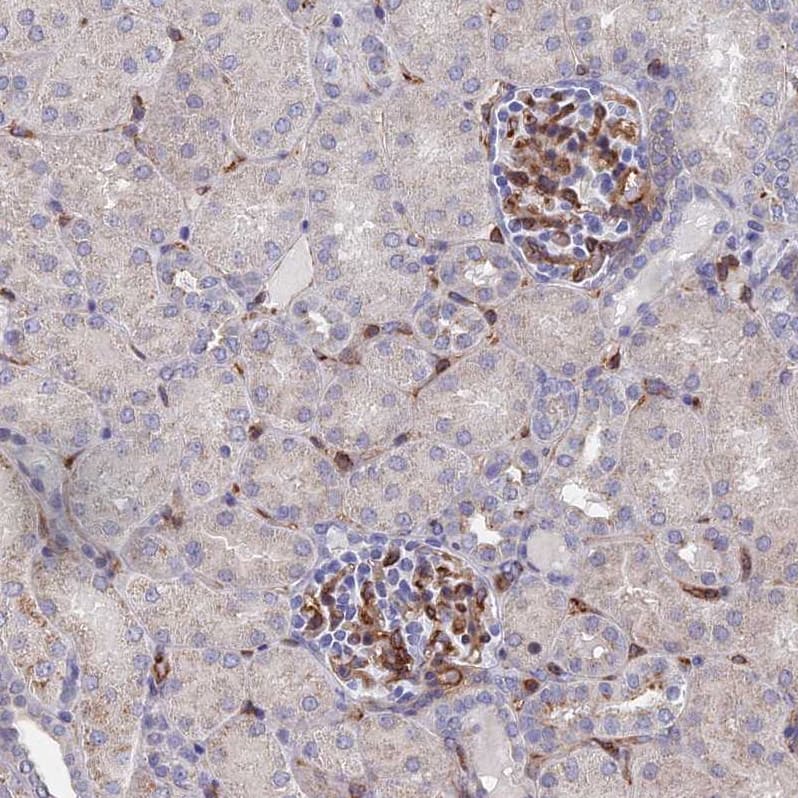 ARAP3 Antibody - BSA Free Immunohistochemistry-Paraffin: ARAP3 Antibody - BSA Free [NBP1-84541]