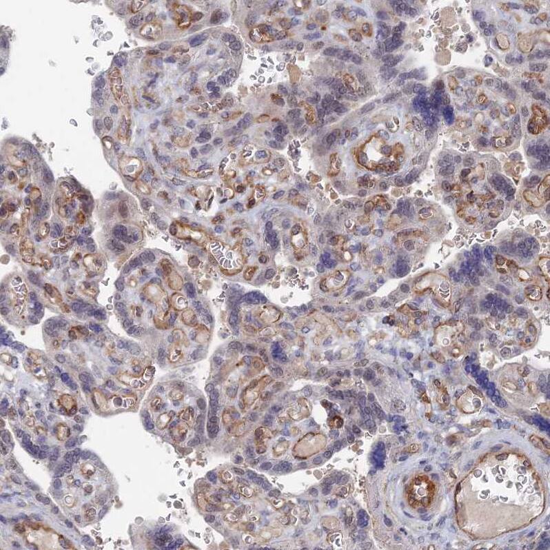 ARAP3 Antibody - BSA Free Immunohistochemistry-Paraffin: ARAP3 Antibody - BSA Free [NBP1-84541]