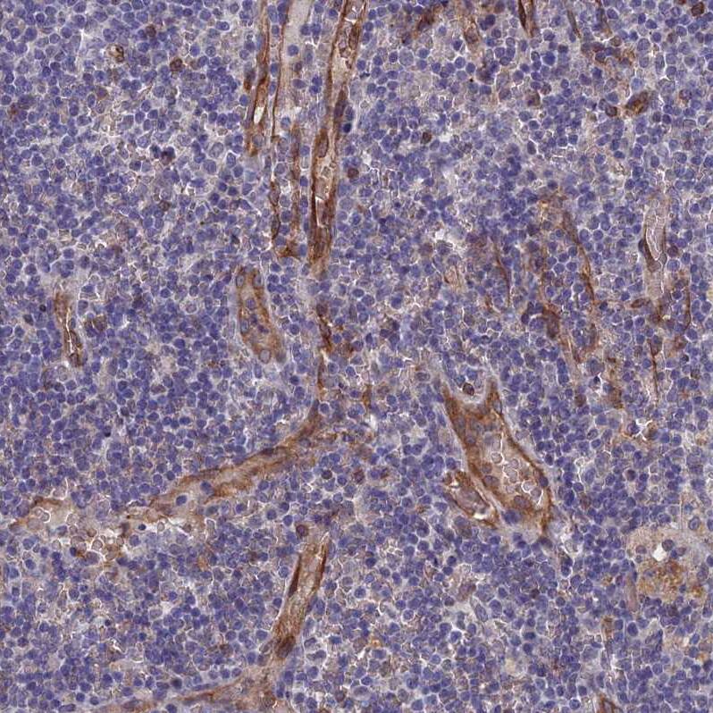 ARAP3 Antibody - BSA Free Immunohistochemistry-Paraffin: ARAP3 Antibody - BSA Free [NBP1-84541]