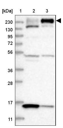 CENTD1 Antibody - BSA Free Western Blot: CENTD1 Antibody - BSA Free [NBP1-84542]