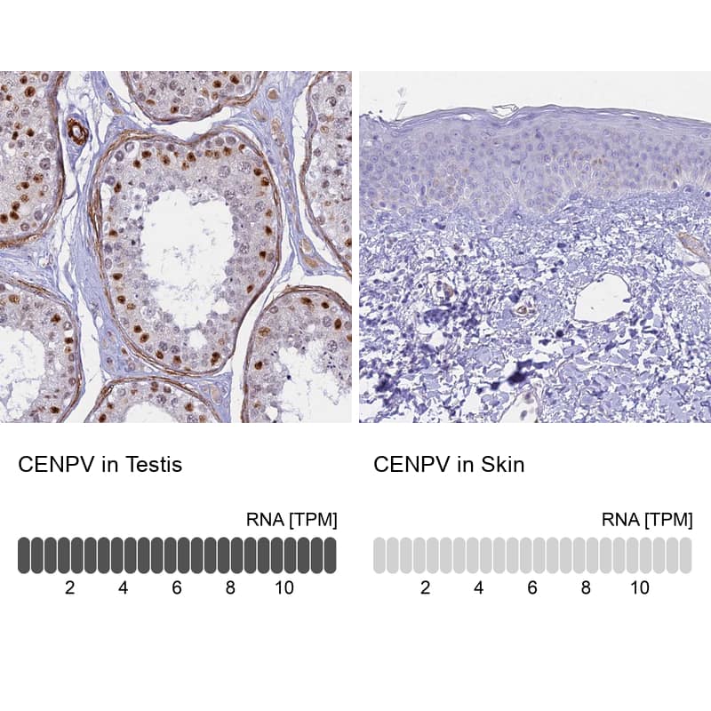 CENPV Antibody - BSA Free Immunohistochemistry-Paraffin: CENPV Antibody - BSA Free [NBP1-84545]