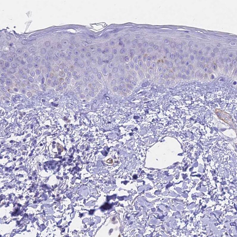 CENPV Antibody - BSA Free Immunohistochemistry-Paraffin: CENPV Antibody - BSA Free [NBP1-84545]