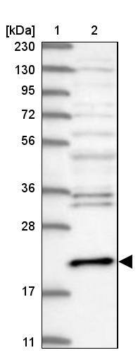Centrin 3 Antibody - BSA Free Western Blot: Centrin 3 Antibody - BSA Free [NBP1-84547]