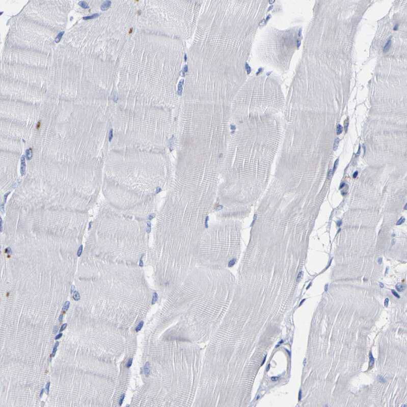HLA DQA1 Antibody - BSA Free Immunohistochemistry-Paraffin: HLA DQA1 Antibody - BSA Free [NBP1-84550]