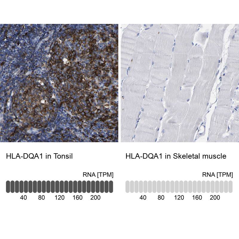 HLA DQA1 Antibody - BSA Free Immunohistochemistry-Paraffin: HLA DQA1 Antibody - BSA Free [NBP1-84550]
