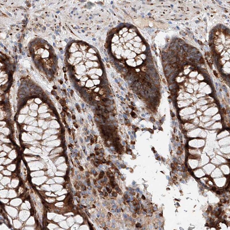 SNAP29 Antibody - BSA Free Immunohistochemistry-Paraffin: SNAP29 Antibody - BSA Free [NBP1-84552]