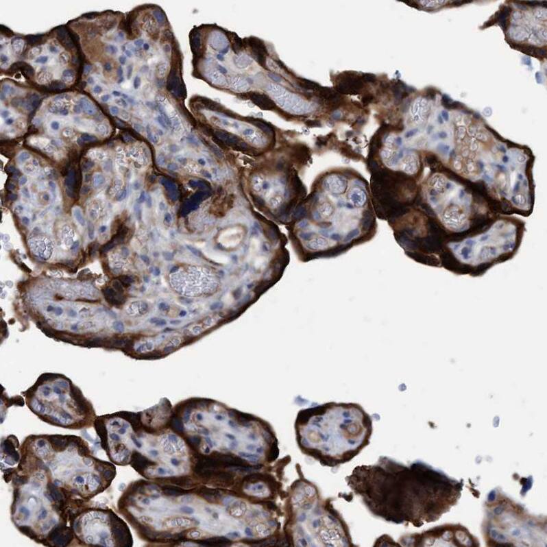 GULP1/CED-6 Antibody - BSA Free Immunohistochemistry-Paraffin: GULP1/CED-6 Antibody - BSA Free [NBP1-84553]