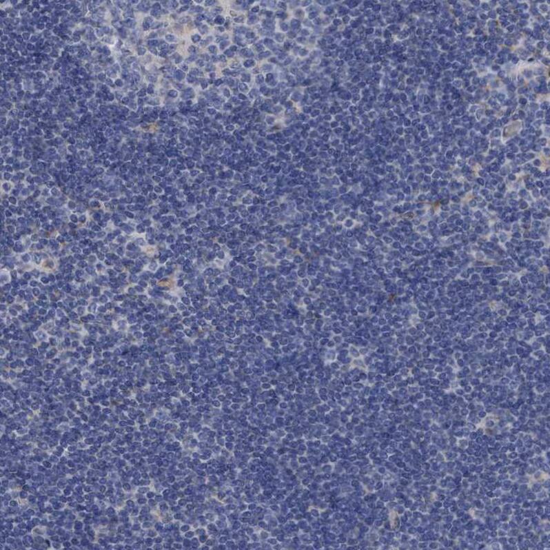 GULP1/CED-6 Antibody - BSA Free Immunohistochemistry-Paraffin: GULP1/CED-6 Antibody - BSA Free [NBP1-84553]