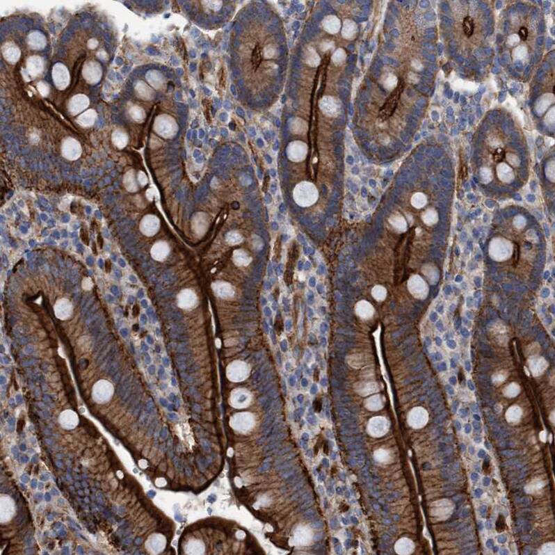 GULP1/CED-6 Antibody - BSA Free Immunohistochemistry-Paraffin: GULP1/CED-6 Antibody - BSA Free [NBP1-84553]