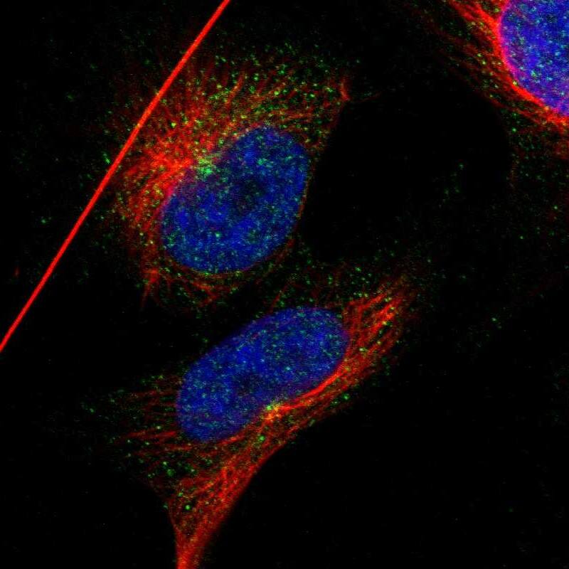 IFT81 Antibody - BSA Free Immunocytochemistry/ Immunofluorescence: IFT81 Antibody [NBP1-84558]