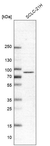 IFT81 Antibody - BSA Free Western Blot: IFT81 Antibody - BSA Free [NBP1-84558]