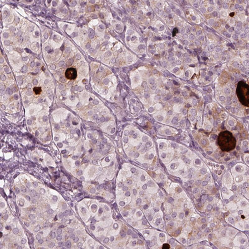 RAB4B Antibody Immunohistochemistry-Paraffin: GNGT1 Antibody [NBP1-84560]