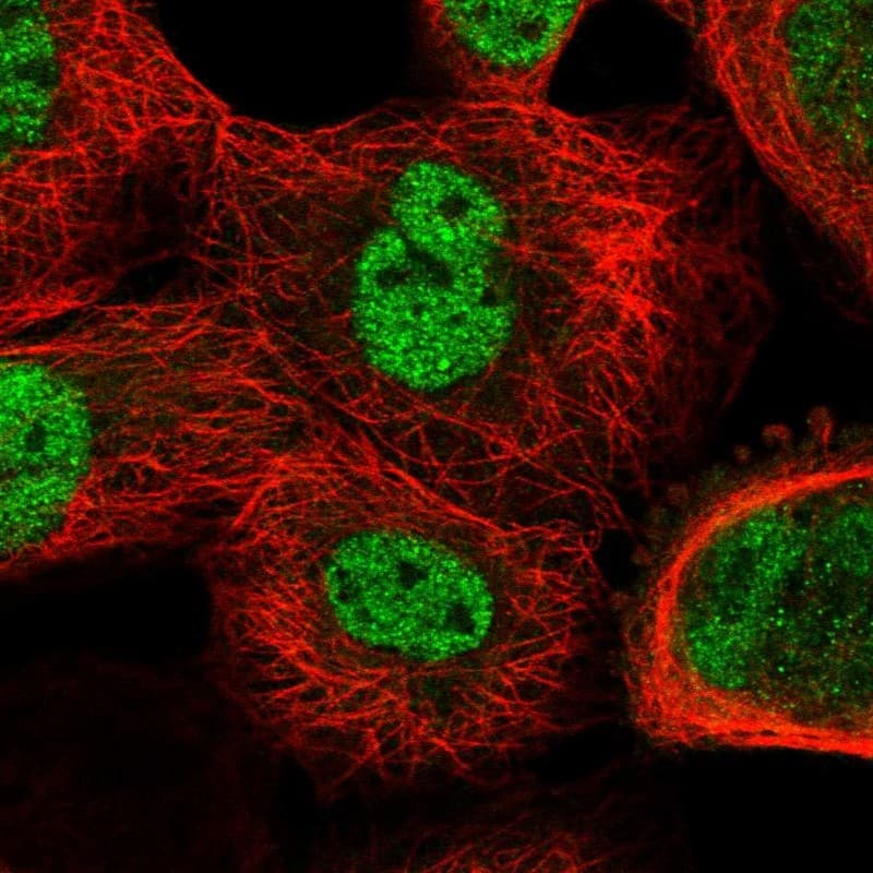 CDR2 Antibody - BSA Free Immunocytochemistry/ Immunofluorescence: CDR2 Antibody [NBP1-84561]